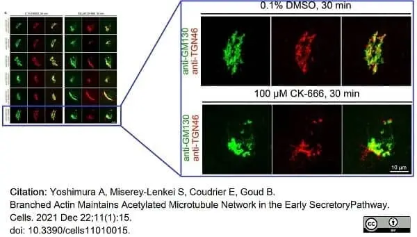 Sheep Anti Human TGN46 Antibody  gallery image 44