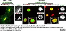 Sheep Anti Human TGN46 Antibody  gallery image 46