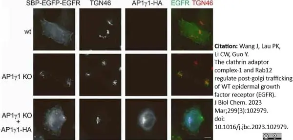 Sheep Anti Human TGN46 Antibody  gallery image 47