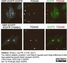 Sheep Anti Human TGN46 Antibody  gallery image 48