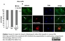 Sheep Anti Human TGN46 Antibody  gallery image 5