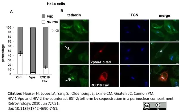 Sheep Anti Human TGN46 Antibody  gallery image 5
