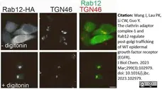 Sheep Anti Human TGN46 Antibody  gallery image 50