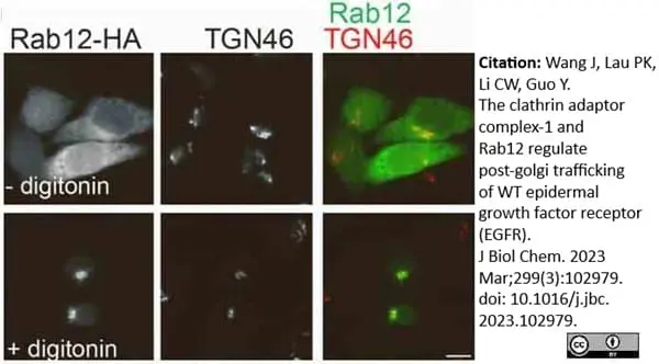 Sheep Anti Human TGN46 Antibody  gallery image 50