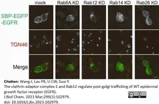 Sheep Anti Human TGN46 Antibody  gallery image 51