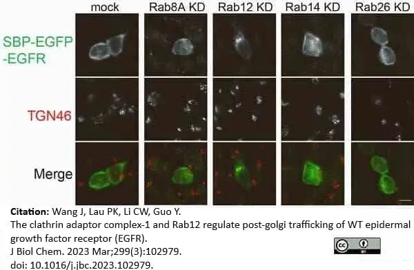 Sheep Anti Human TGN46 Antibody  gallery image 51