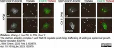 Sheep Anti Human TGN46 Antibody  gallery image 53