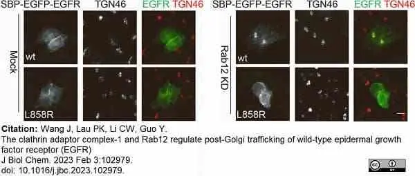 Sheep Anti Human TGN46 Antibody  gallery image 53