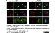 Sheep Anti Human TGN46 Antibody  gallery image 55