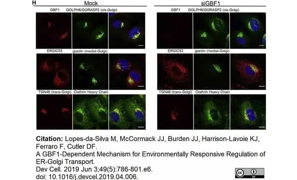 Sheep Anti Human TGN46 Antibody  gallery image 55