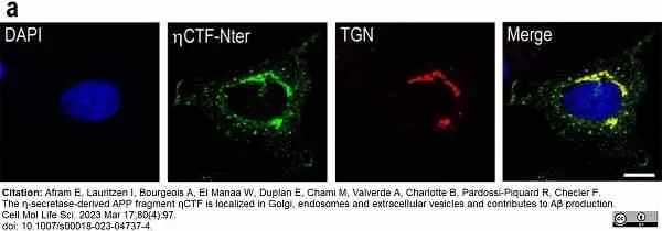 Sheep Anti Human TGN46 Antibody  gallery image 58