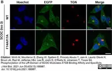 Sheep Anti Human TGN46 Antibody  gallery image 59