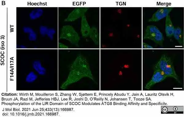 Sheep Anti Human TGN46 Antibody  gallery image 59