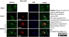 Sheep Anti Human TGN46 Antibody  gallery image 6