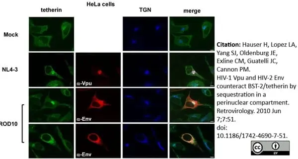 Sheep Anti Human TGN46 Antibody  gallery image 6