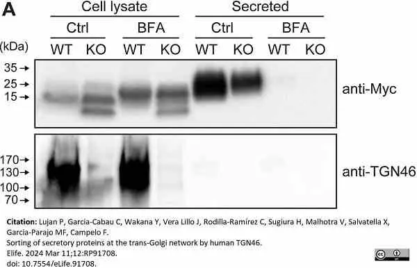Sheep Anti Human TGN46 Antibody  gallery image 60