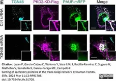 Sheep Anti Human TGN46 Antibody  gallery image 61