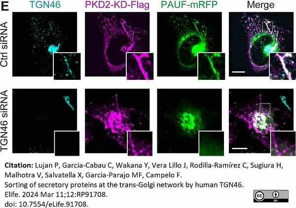 Sheep Anti Human TGN46 Antibody  gallery image 61