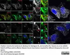 Sheep Anti Human TGN46 Antibody  gallery image 62