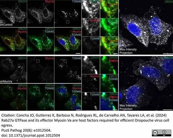 Sheep Anti Human TGN46 Antibody  gallery image 62