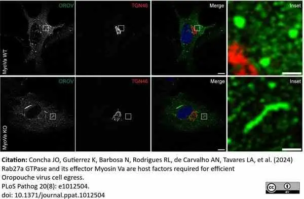 Sheep Anti Human TGN46 Antibody  gallery image 63