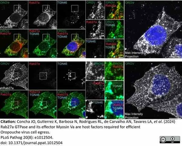 Sheep Anti Human TGN46 Antibody  gallery image 64