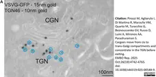 Sheep Anti Human TGN46 Antibody  gallery image 68