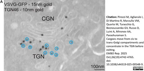 Sheep Anti Human TGN46 Antibody  gallery image 68