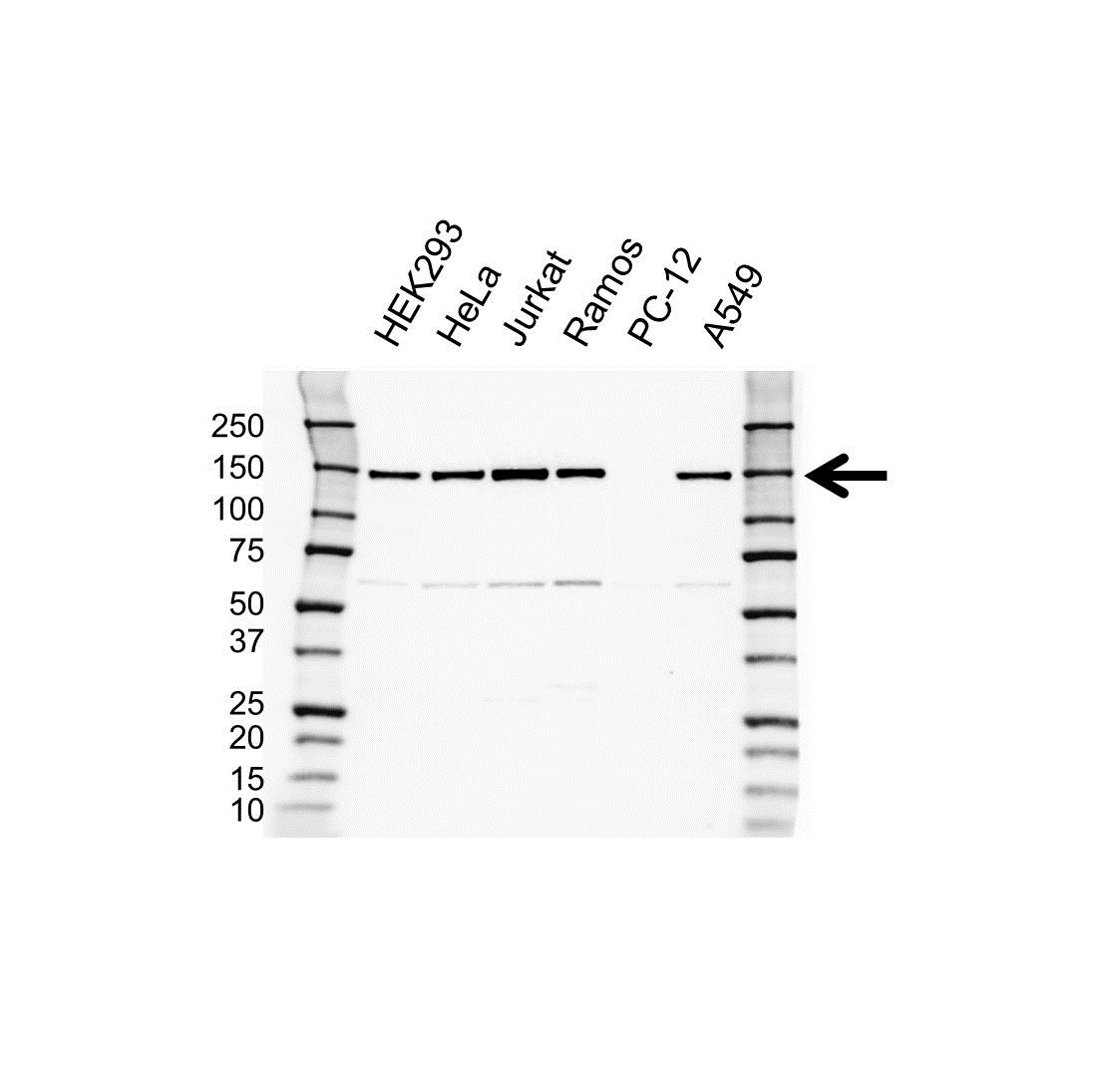 Anti THRAP3 Antibody (PrecisionAb Polyclonal Antibody) gallery image 1