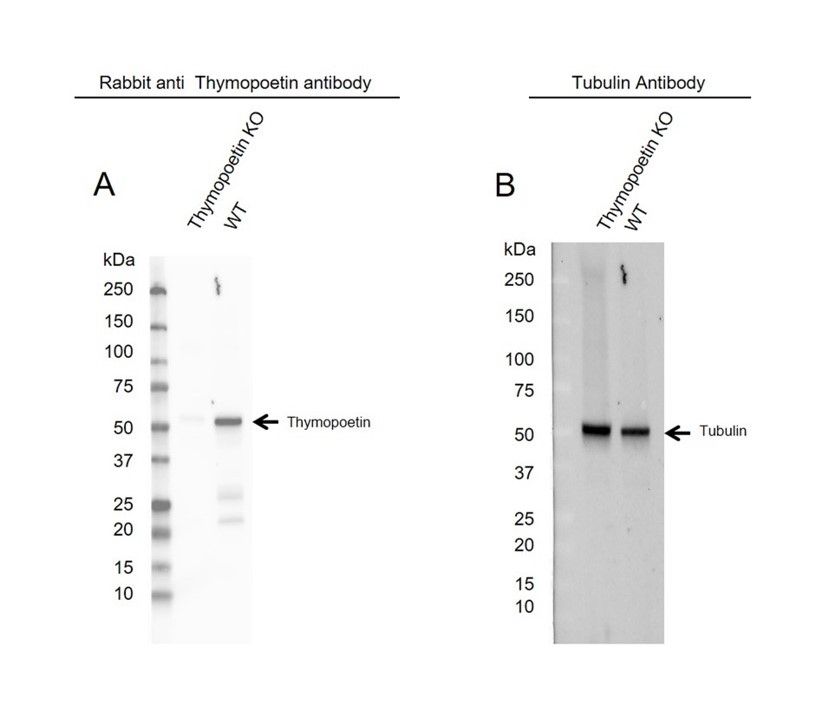 Anti Thymopoetin Antibody (PrecisionAb Polyclonal Antibody) gallery image 2