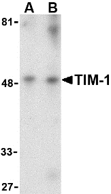 Anti TIM-1 Antibody gallery image 1