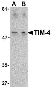 Anti TIM-4 (C-Terminal) Antibody gallery image 1