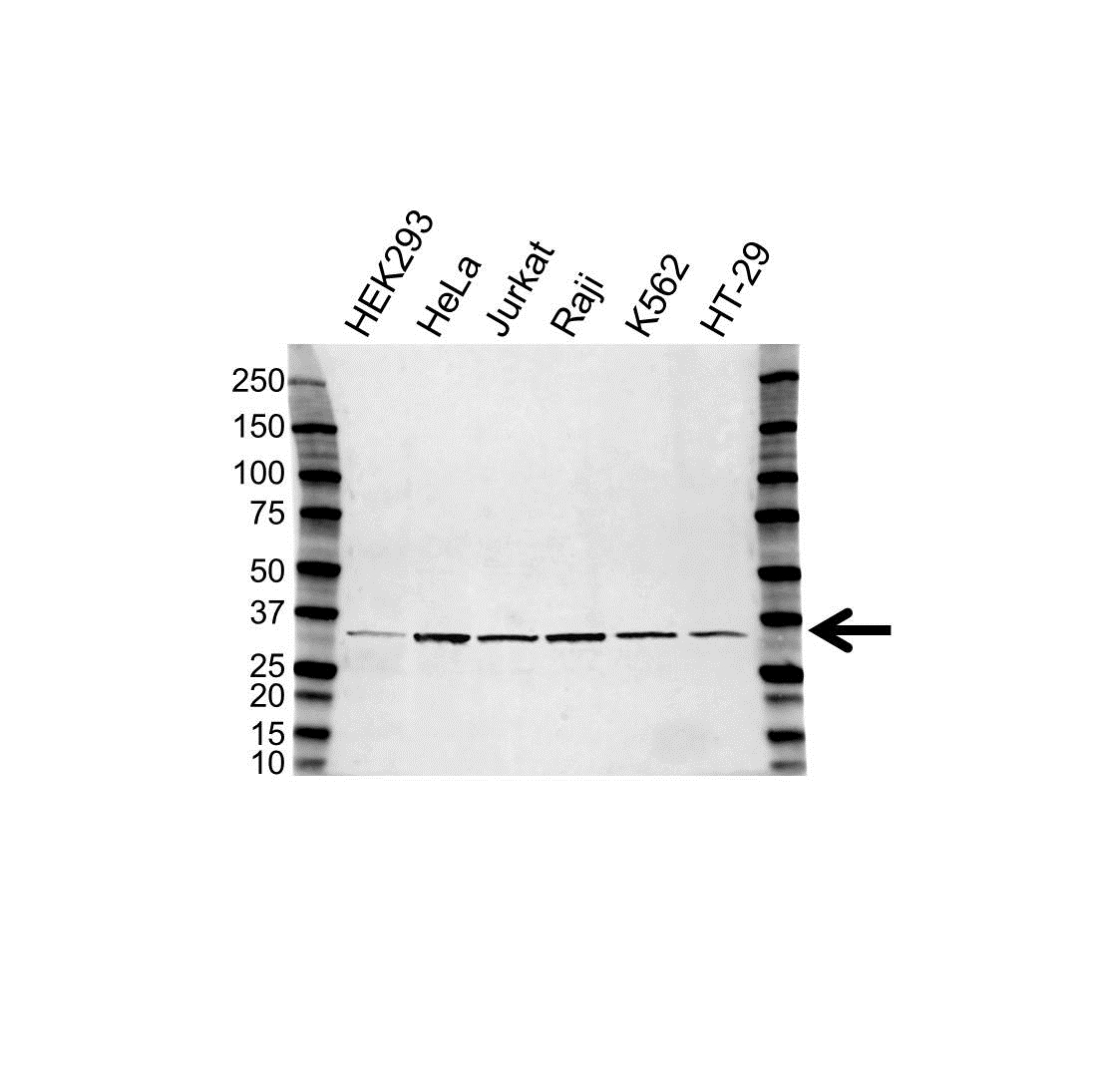 Anti TIMP-1 Antibody (PrecisionAb Polyclonal Antibody) gallery image 1
