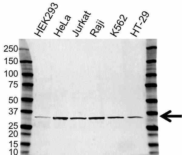 Anti TIMP-1 Antibody (PrecisionAb Polyclonal Antibody) gallery image 1