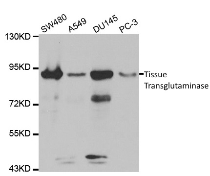Anti Tissue Transglutaminase Antibody gallery image 1