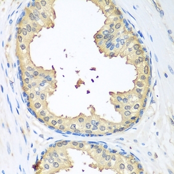 Anti Tissue Transglutaminase Antibody gallery image 2