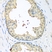 Anti Tissue Transglutaminase Antibody thumbnail image 2