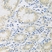 Anti Tissue Transglutaminase Antibody thumbnail image 3