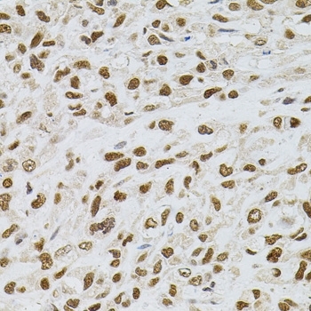 Anti Tissue Transglutaminase Antibody gallery image 5