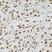 Anti Tissue Transglutaminase Antibody thumbnail image 5