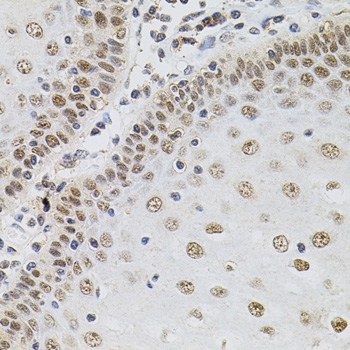 Anti Tissue Transglutaminase Antibody gallery image 6