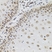 Anti Tissue Transglutaminase Antibody thumbnail image 6