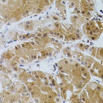 Anti Tissue Transglutaminase Antibody gallery image 7