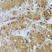 Anti Tissue Transglutaminase Antibody thumbnail image 7