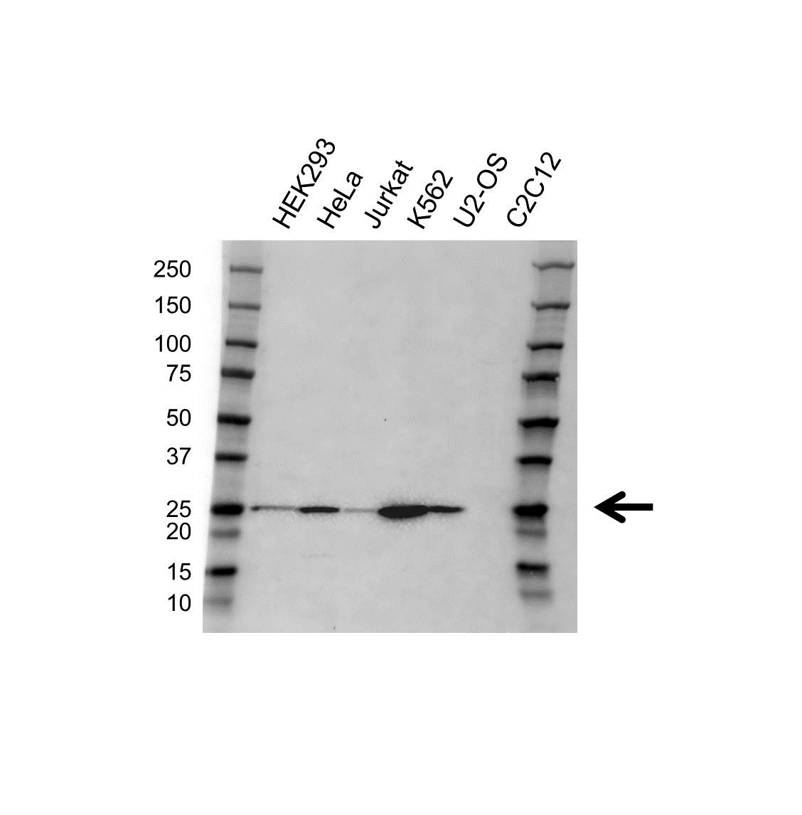 Anti TK1 Antibody (PrecisionAb Polyclonal Antibody) gallery image 1