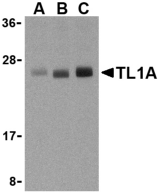 Anti TL1A (N-Terminal) Antibody gallery image 1