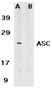 Anti Human TMS1 (C-Terminal) Antibody thumbnail image 1
