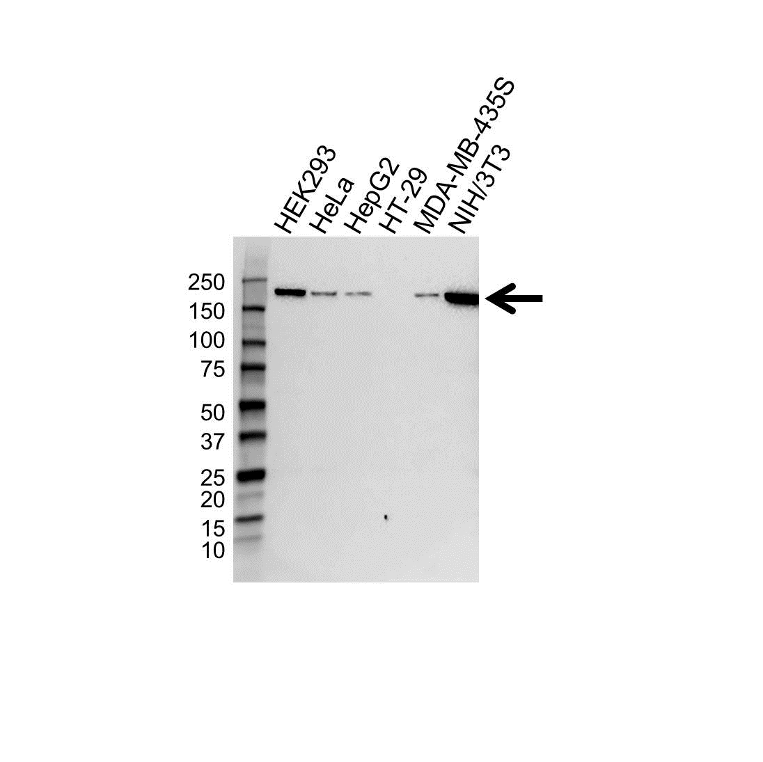 Anti Topoisomerase II Alpha Antibody (PrecisionAb Polyclonal Antibody) gallery image 1