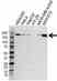 Anti Topoisomerase II Alpha Antibody (PrecisionAb Polyclonal Antibody) thumbnail image 3