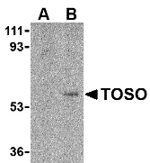 Anti Human TOSO (C-Terminal) Antibody gallery image 1